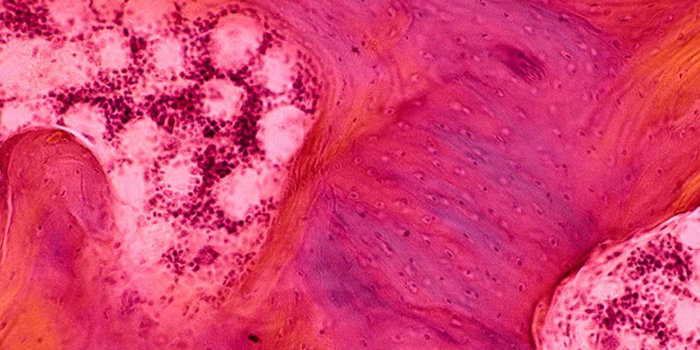 Blood slide stain.